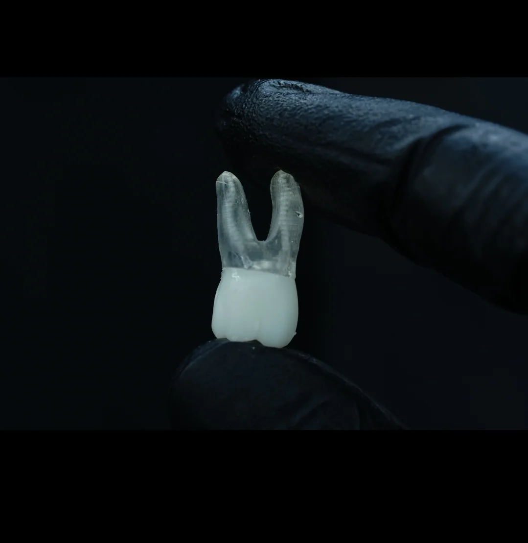 Lower First Molar — image 1 of 3