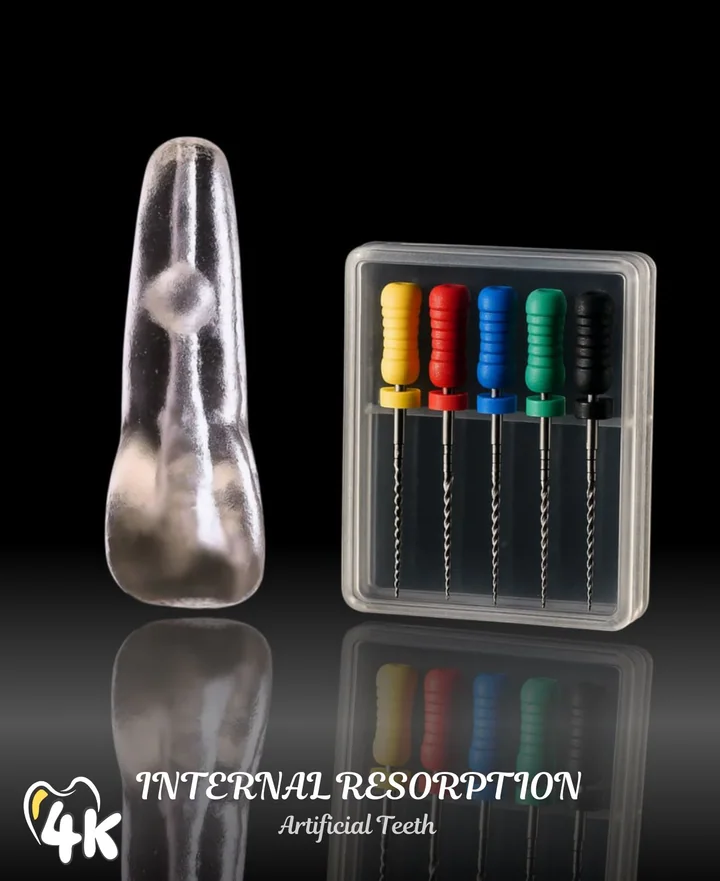 Internal Resorption — Incisor — 4K-IRS-CI